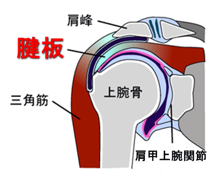 腱板断裂